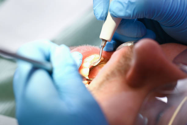Best Orthodontic Emergency Dentist in Brentwood, MD