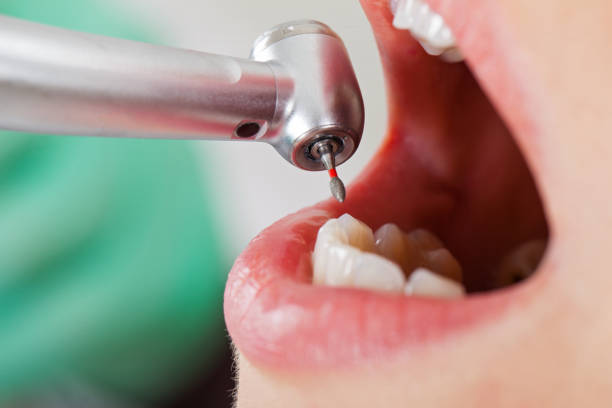 Best Mobile Emergency Dentist in Brentwood, MD
